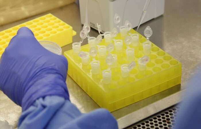 HIV atinge 38 milhões de pessoas em todo o mundo (Divulgação/Josué Damascena (IOC/Fiocruz)) HIV atinge 38 milhões de pessoas em todo o mundo (Divulgação/Josué Damascena (IOC/Fiocruz))