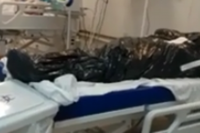 (Caso ocorreu na UTI do Hospital de Santa Maria. Foto: Material cedido ao Correio) (Caso ocorreu na UTI do Hospital de Santa Maria. Foto: Material cedido ao Correio)