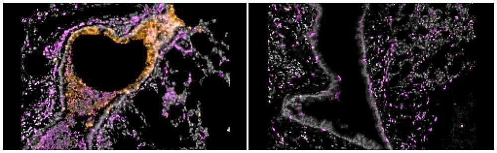 (As células de defesa artificiais reduzem a presença do Sars-CoV-2 no corpo das cobaias em um milhão de vezes. Foto: Nambulli et al./Science Advances) (As células de defesa artificiais reduzem a presença do Sars-CoV-2 no corpo das cobaias em um milhão de vezes. Foto: Nambulli et al./Science Advances)