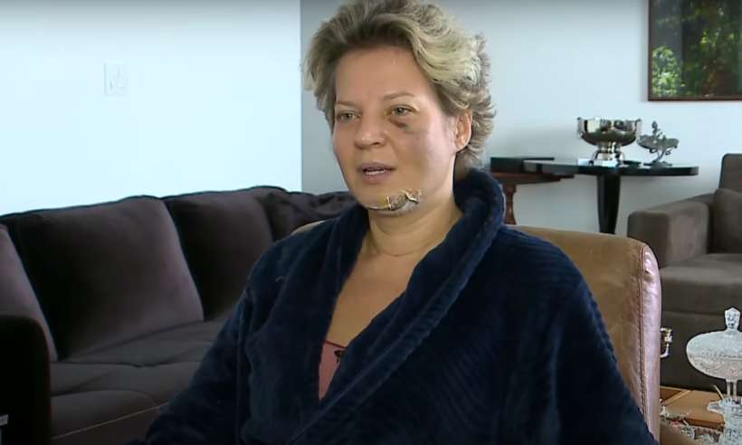 (Deputada federal apareceu com cinco fraturas no rosto e outras pelo corpo, e diz que pode ter sido vítima de atentado. Foto: Reprodução) (Deputada federal apareceu com cinco fraturas no rosto e outras pelo corpo, e diz que pode ter sido vítima de atentado. Foto: Reprodução)