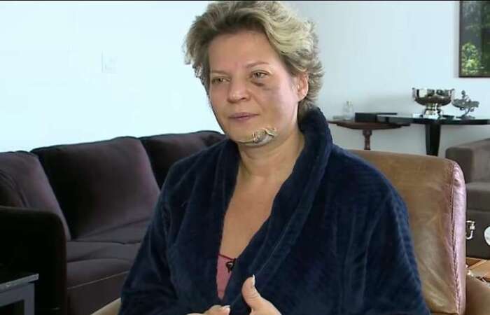 Polícia: Joice Hasselmann 'caiu da própria altura' e não foi agredida | Política: Diario de Pernambuco - Vimarsana News