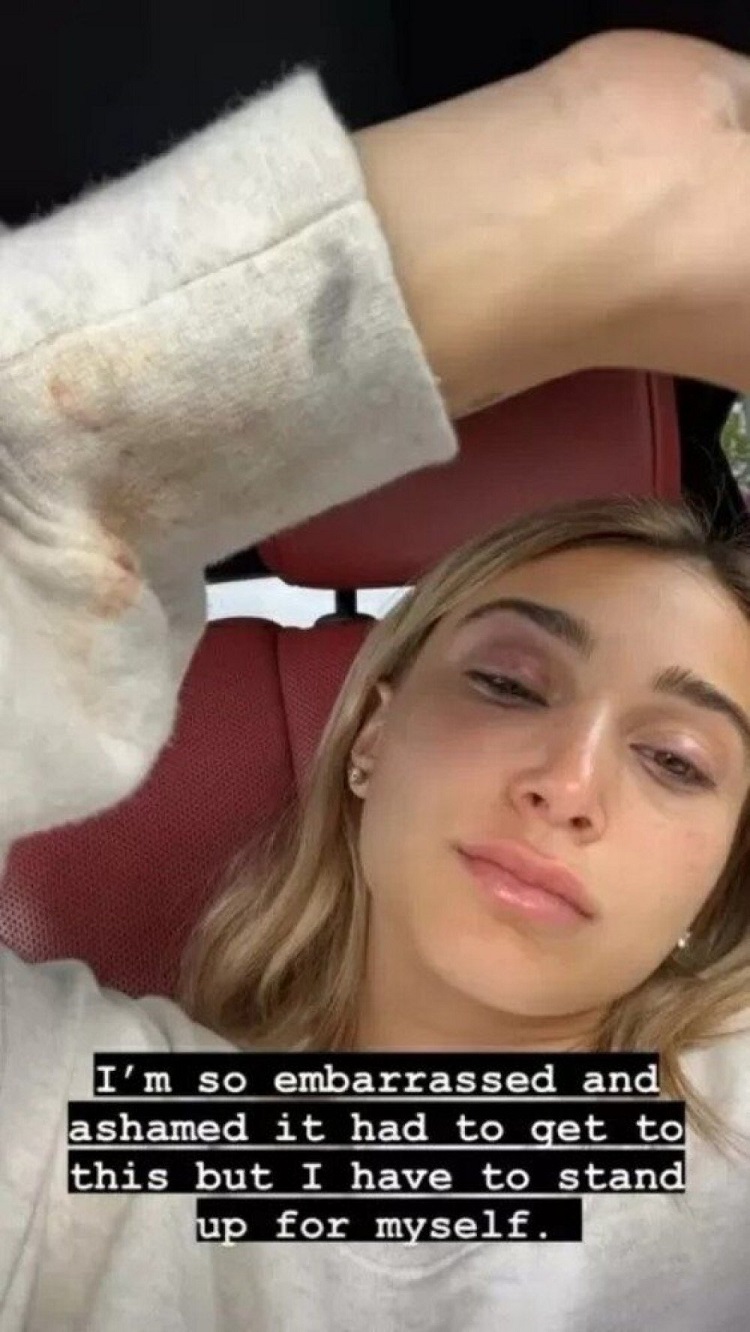 Ex-namorada de Tyga acusa rapper de agresso
 (Instagram/Reproduo)