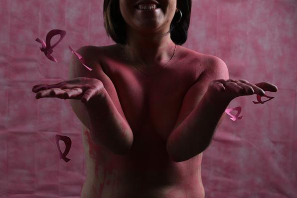 Em Pernambuco, em 2020, 801 mulheres faleceram em decorrência do câncer de mama e 315 por conta da neoplasia do colo do útero.
(Brenda Alacântara/Esp. DP
) Em Pernambuco, em 2020, 801 mulheres faleceram em decorrência do câncer de mama e 315 por conta da neoplasia do colo do útero.
(Brenda Alacântara/Esp. DP
)