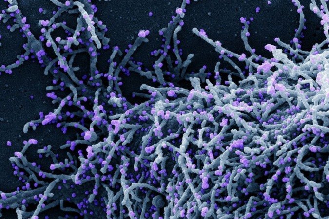 (Foto: National Institute of Allergy and Infectious Diseases /NIAID/Direitos reservados) (Foto: National Institute of Allergy and Infectious Diseases /NIAID/Direitos reservados)