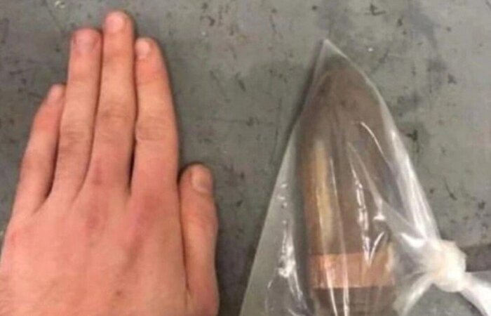 Esquadrão Anti Bombas é acionado em Hospital na Inglaterra após atender um paciente com um projétil de artilharia introduzido no reto (Foto: Reprodução/The Sun) Esquadrão Anti Bombas é acionado em Hospital na Inglaterra após atender um paciente com um projétil de artilharia introduzido no reto (Foto: Reprodução/The Sun)
