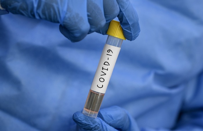 Pernambuco registra mais de 4 mil casos da Covid-19 nesta terça | Local:  Diario de Pernambuco