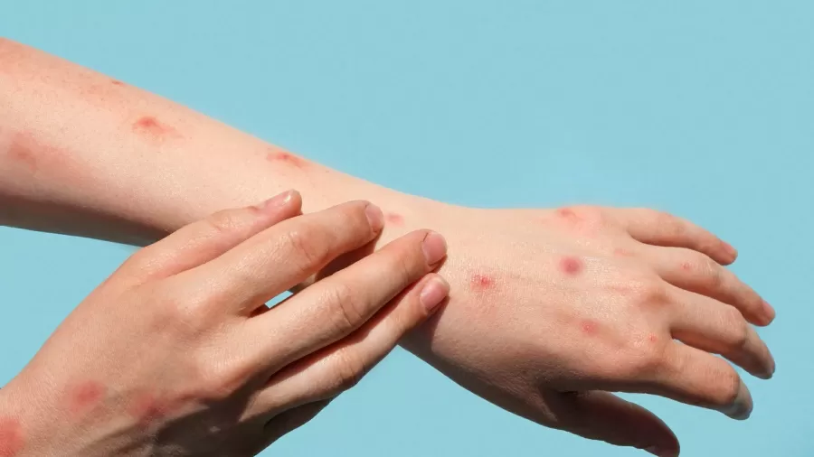 (Crédito: istock
) (Crédito: istock
)