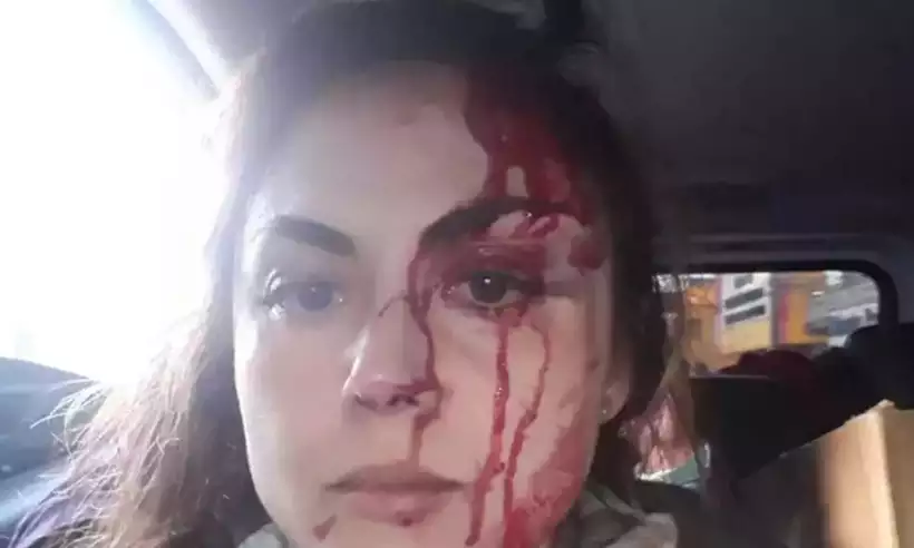 Procuradora-geral Gabriela Samadello Monteiro Barros, foi agredida pelo colega nessa segunda-feira (20/6), dentro da prefeitura onde trabalham (Foto: Redes Sociais/Reprodução) Procuradora-geral Gabriela Samadello Monteiro Barros, foi agredida pelo colega nessa segunda-feira (20/6), dentro da prefeitura onde trabalham (Foto: Redes Sociais/Reprodução)