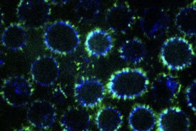 (Foto: Johns Hopkins University) (Foto: Johns Hopkins University)