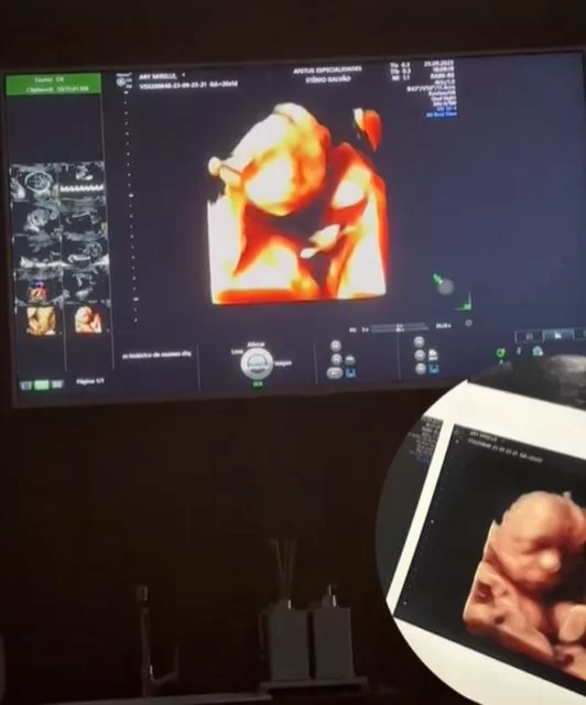 Ultrassom 4D do filho do casal  (foto: Reproduo/Instagram )