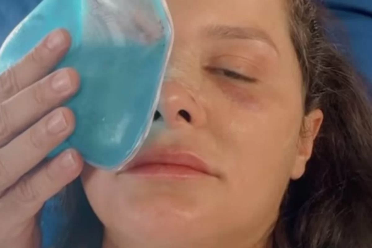Maraisa contou, ainda, como foram os primeiros momentos após o acidente e revelou que precisou passar por uma cirurgia. (Foto: Reprodução/Instagram) Maraisa contou, ainda, como foram os primeiros momentos após o acidente e revelou que precisou passar por uma cirurgia. (Foto: Reprodução/Instagram)